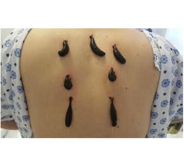 Limora Dna��manl�k